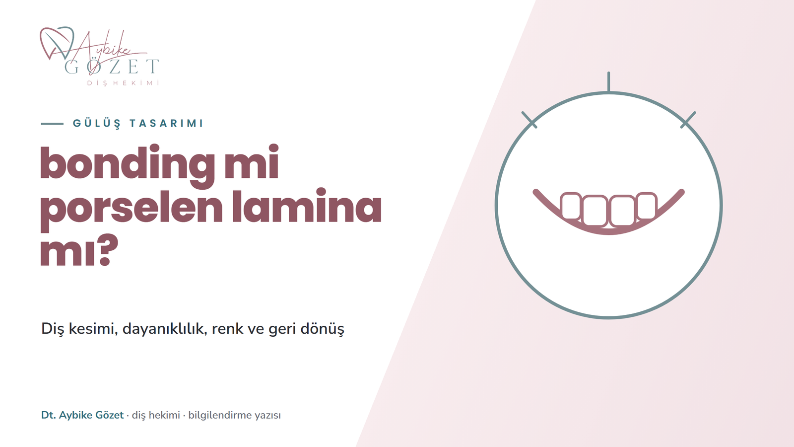 Bonding mi porselen lamina mı: farklar ve kimlere uygun