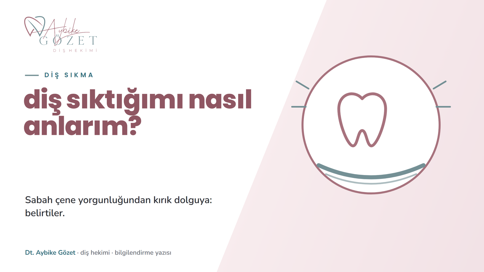 Diş sıkma belirtileri: çene yorgunluğu, diş aşınması ve kırık dolgular