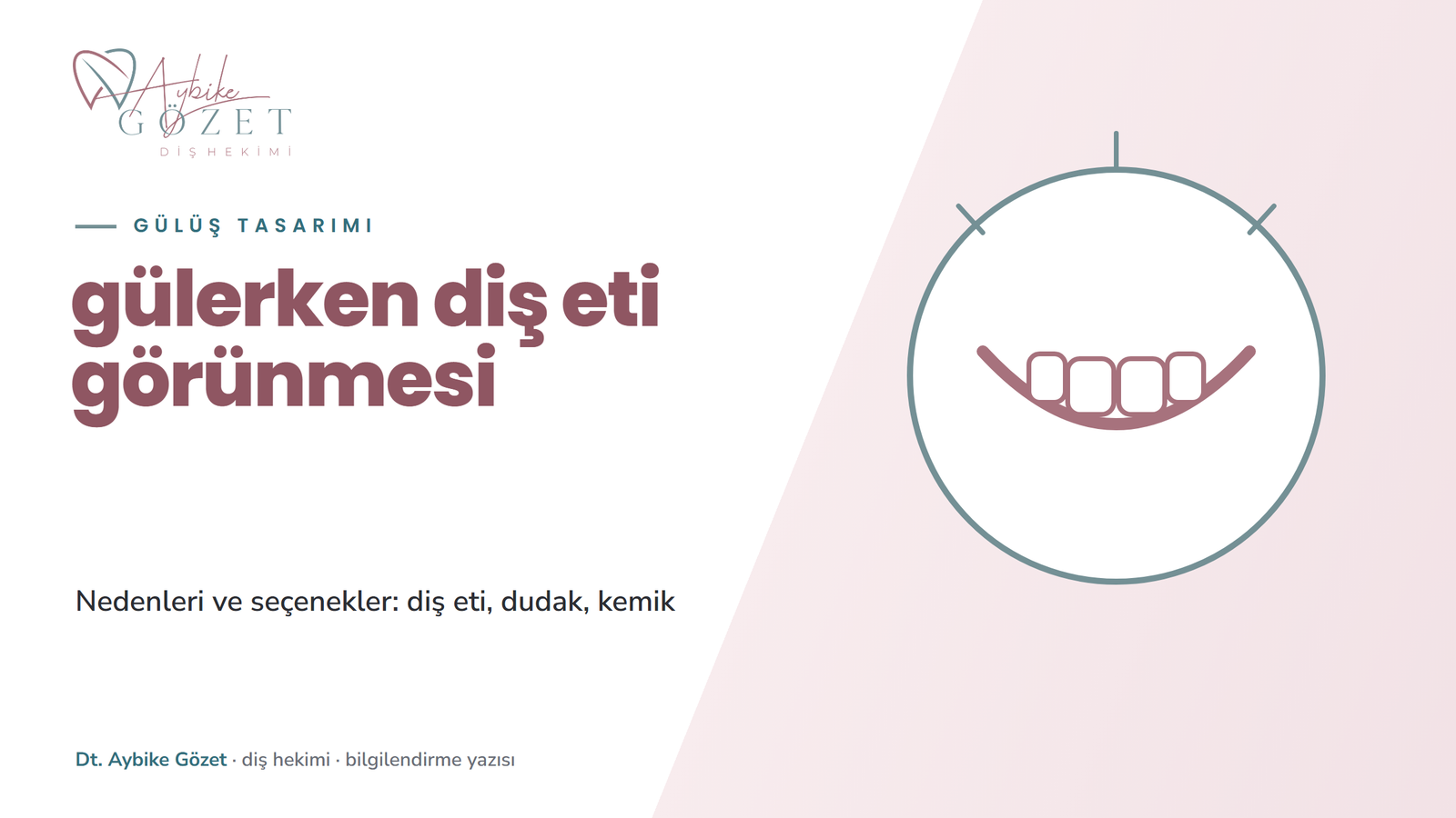 Gülerken diş eti görünmesi: nedenleri ve seçenekler
