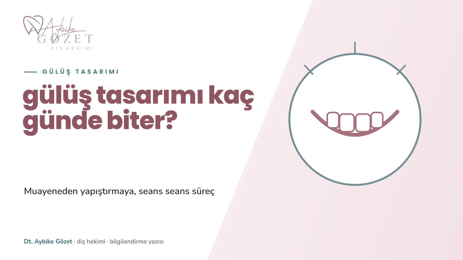 Gülüş tasarımı kaç günde biter: seans seans süreç
