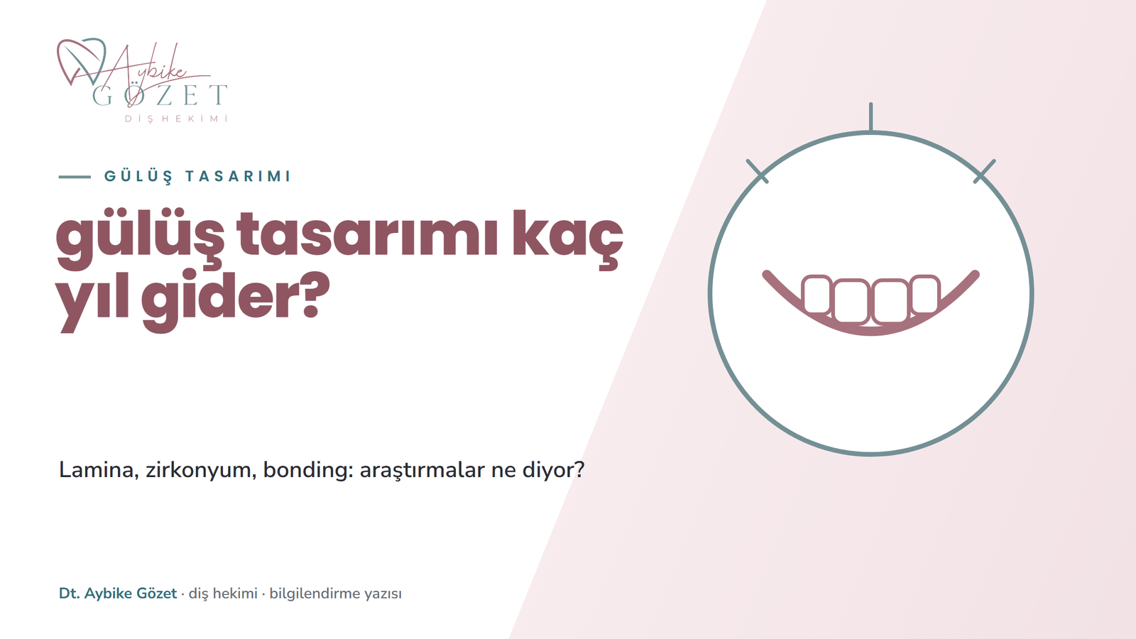 Gülüş tasarımı kaç yıl gider: lamina, zirkonyum ve bonding ömrü