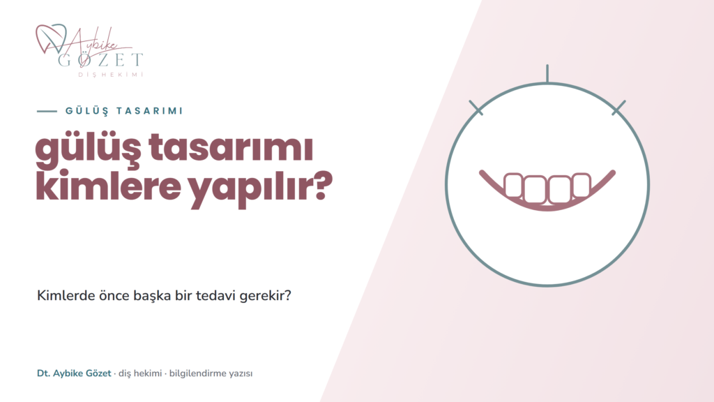 Gülüş tasarımı kimlere yapılır, kimlere yapılmaz