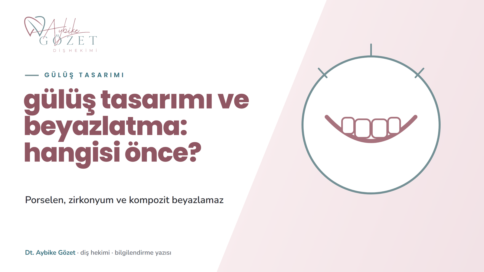 Gülüş tasarımı ve diş beyazlatma: doğru sıra
