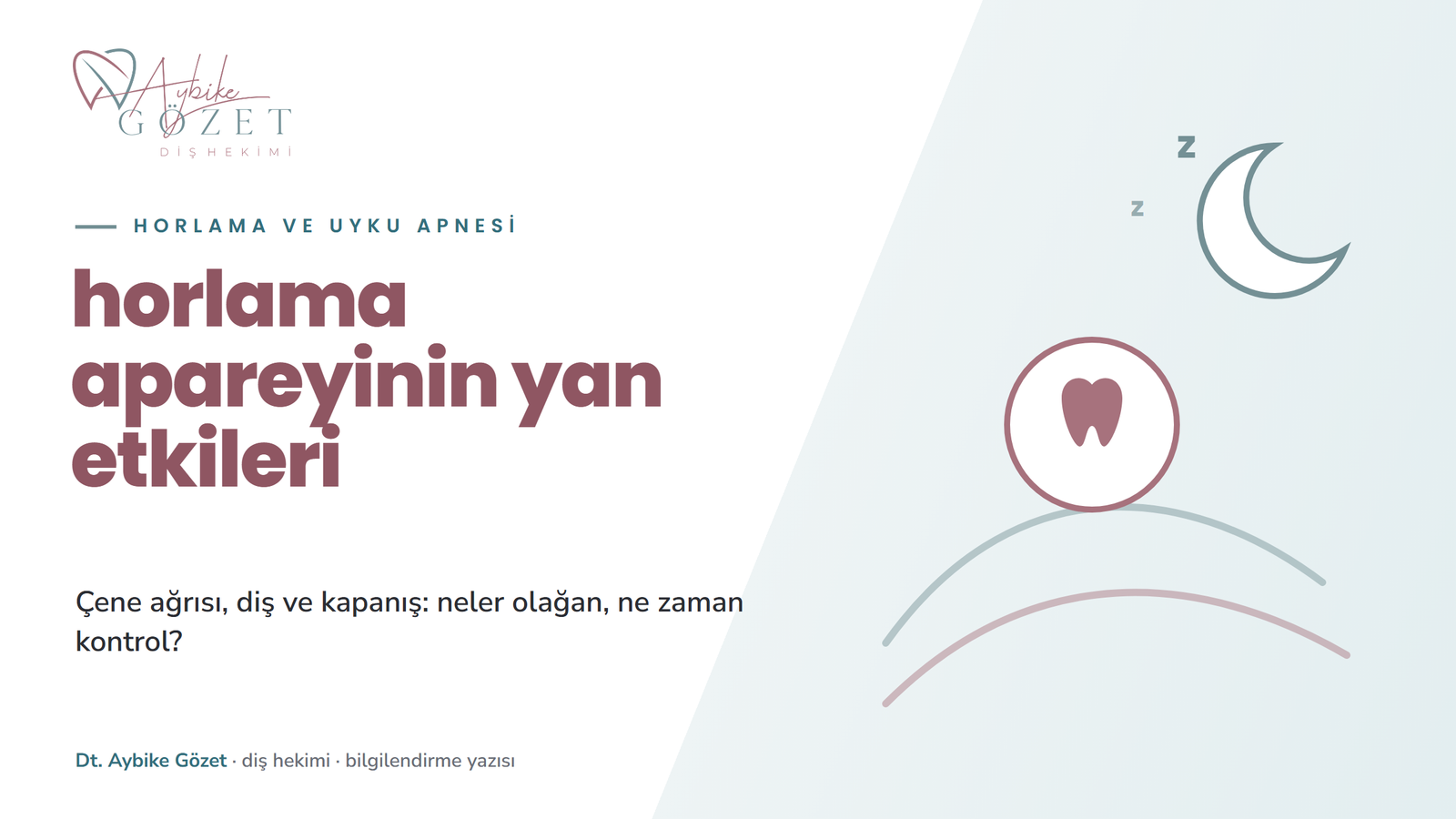 Horlama apareyi yan etkileri: çene ağrısı, diş ve kapanış