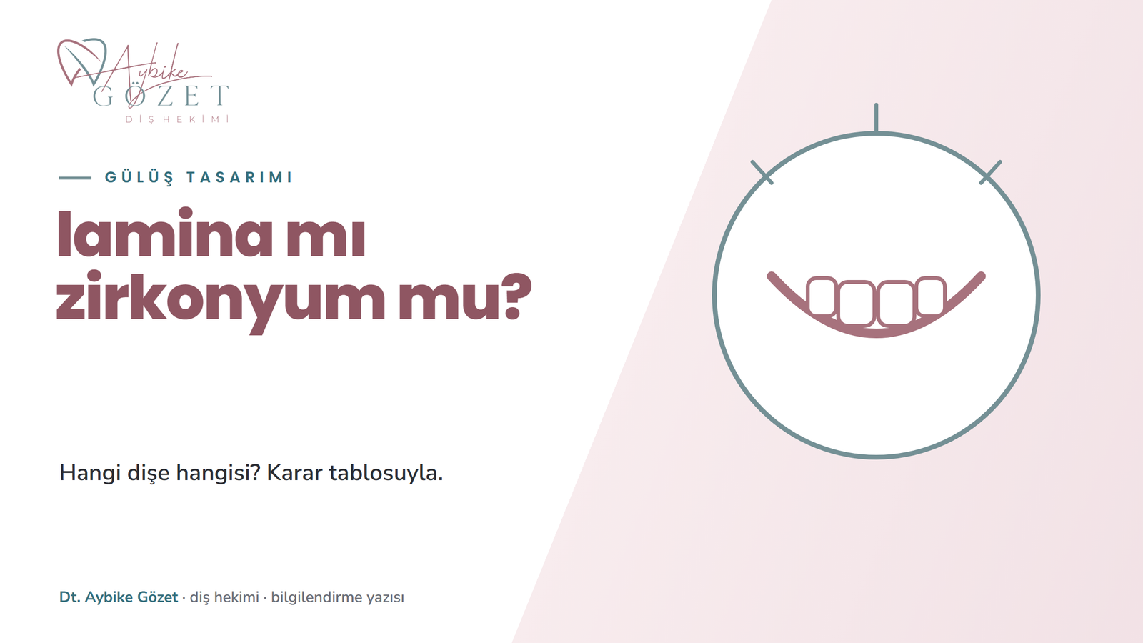 Lamina mı zirkonyum mu: hangi dişe hangisi